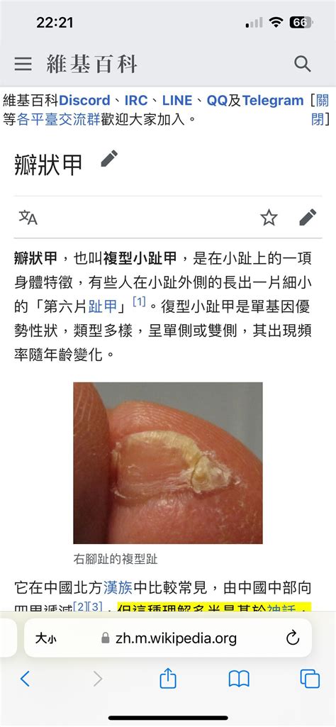 腳小拇指|獨家／漢人特徵？腳「小拇指」兩瓣！生物師破謠：跟直髮一樣是。